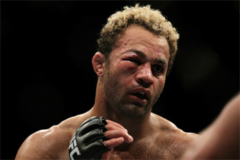 Nasty eye injury at UFC 124