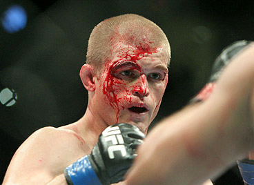 Evan Dunham UFC 119