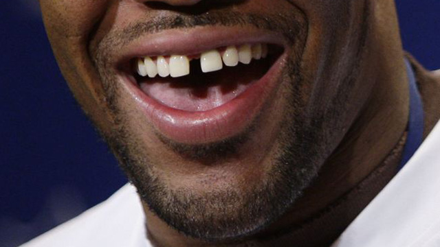 Michael Strahan Teeth Gap