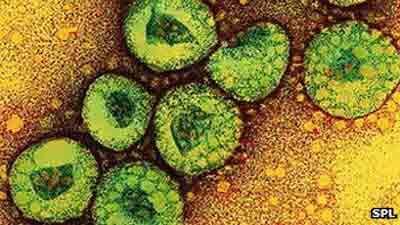 mysterious virus spreads, new the strain of SARS,  coronavirus, coronavirus found in Saudi Arabia and Pakistan 