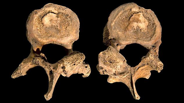 King Richard III had scoliosis, remains found under Leicester car park