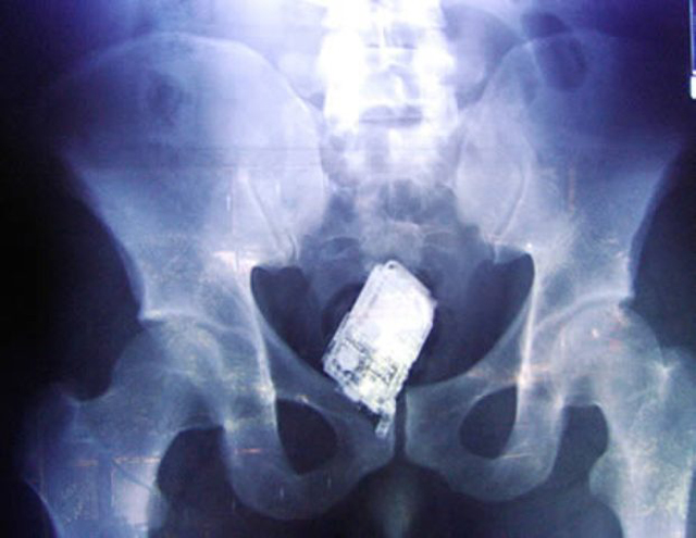 Craziest X Ray Images