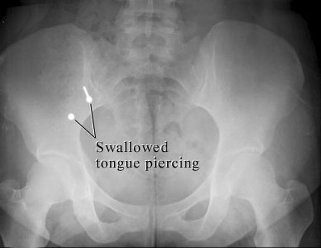 Body piercing problem