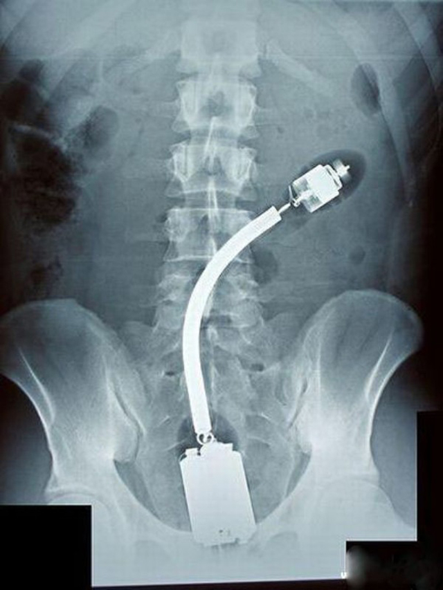 20 Craziest X Ray Images 