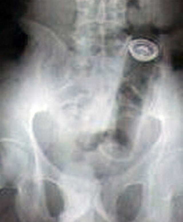 x-ray-16
