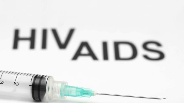 HIV AIDS, HIV CURE, AIDS CURE