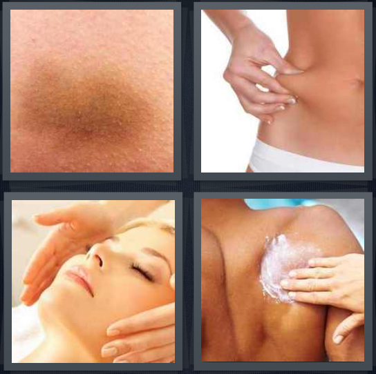 4 Pics 1 Word Answer 4 letters for bruise on body, woman pinching flesh, woman receiving facial, lotion being massaged into back
