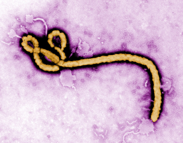 ebola pictures, ebola victim pictures, ebola virus photos