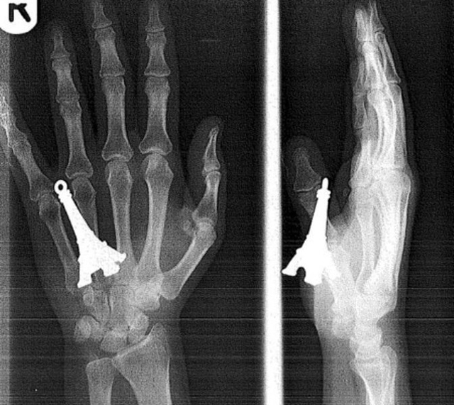 Biggest didlo ever 20 Craziest X Ray Images Heavy Com