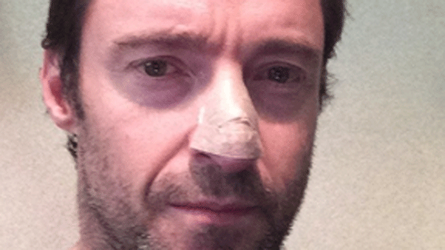 Hugh Jackman Skin Cancer 5 Fast Facts You Need To Know