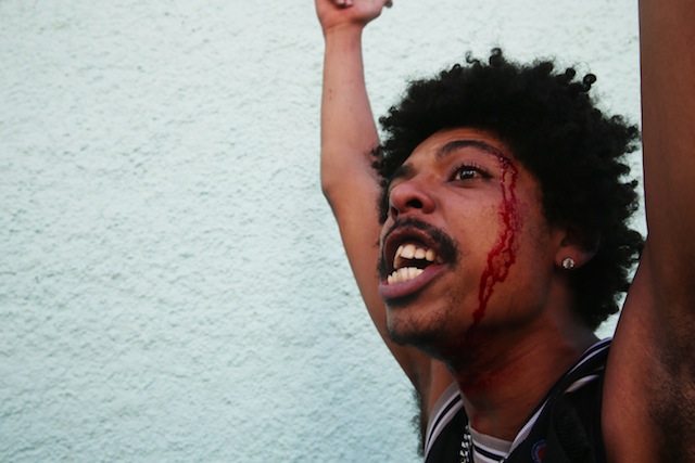 injured protestors brazil
