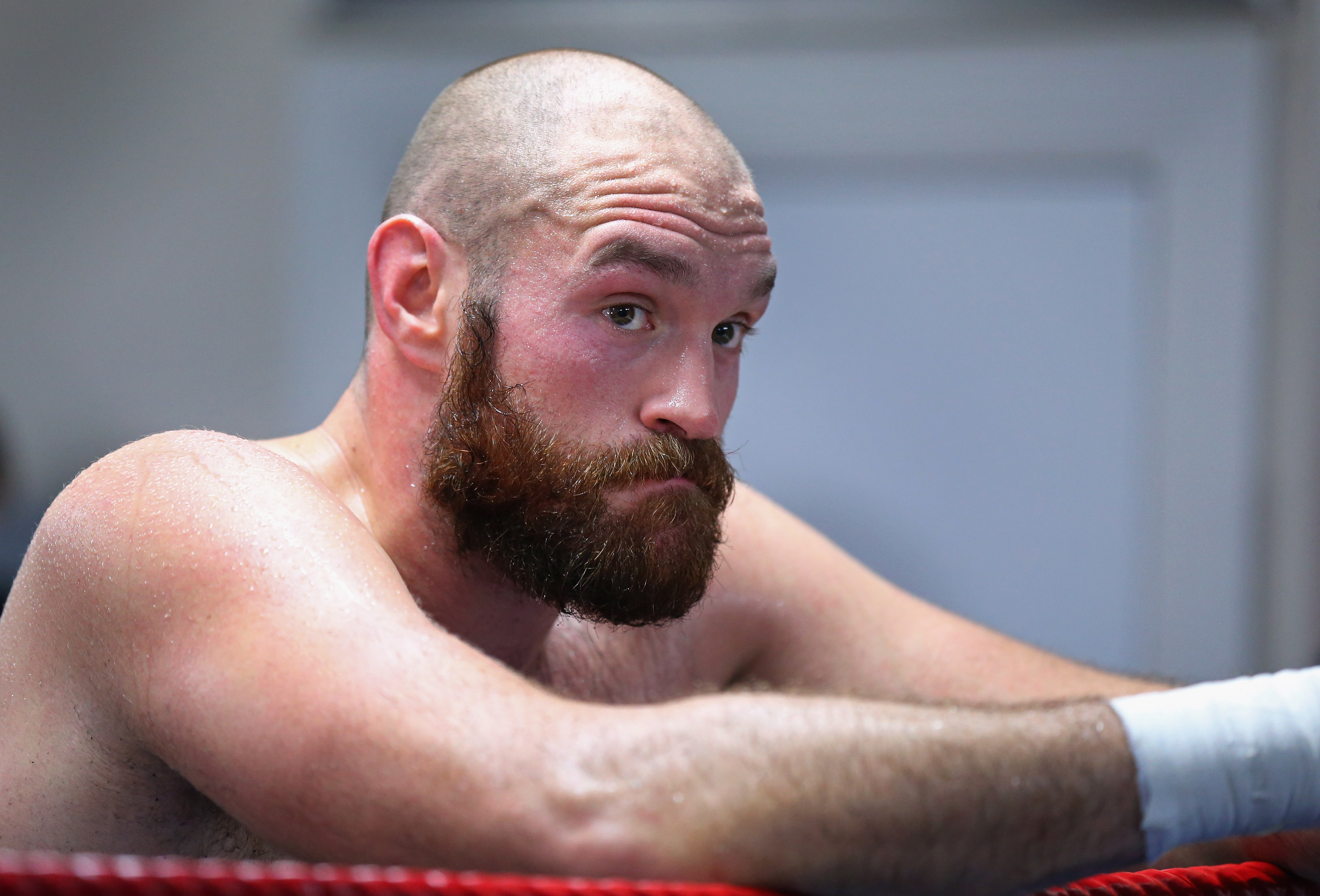 WATCH Tyson Fury Punches Himself in the Face Heavy