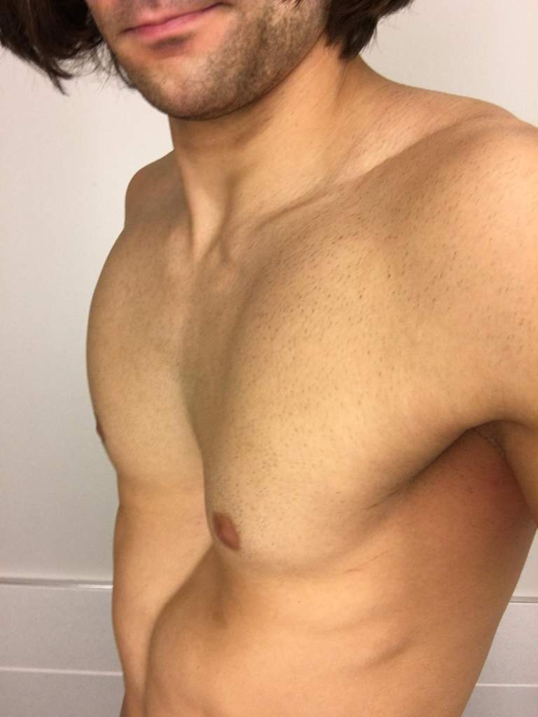 Can I get a big chest if I have Pectus Excavatum? : r/Fitness