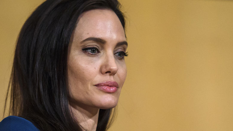 Angelina Jolie Bell's Palsy