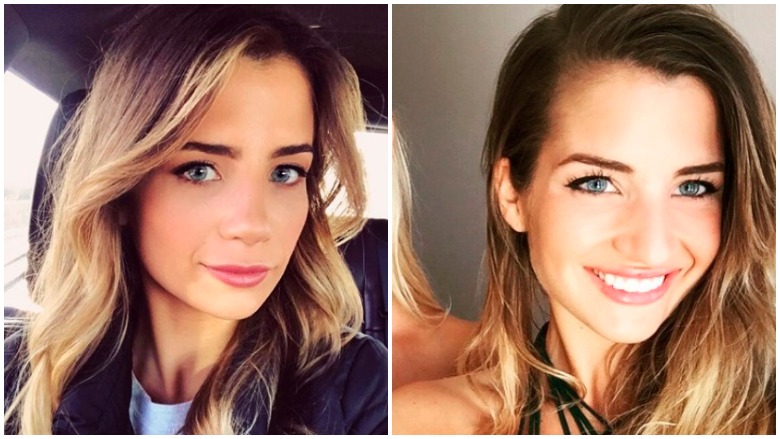 Naomie Olindo Nose Job Now: Plastic Surgery Before & After