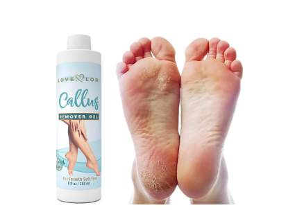 Love Lori bottle with calluses and smooth feet