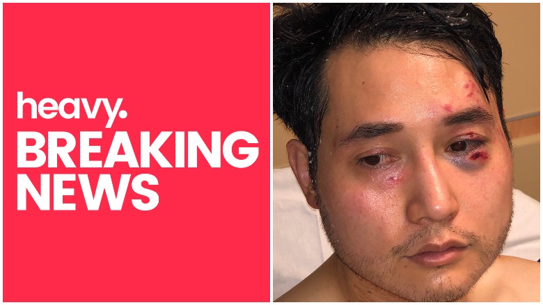 Andy Ngo Attacked