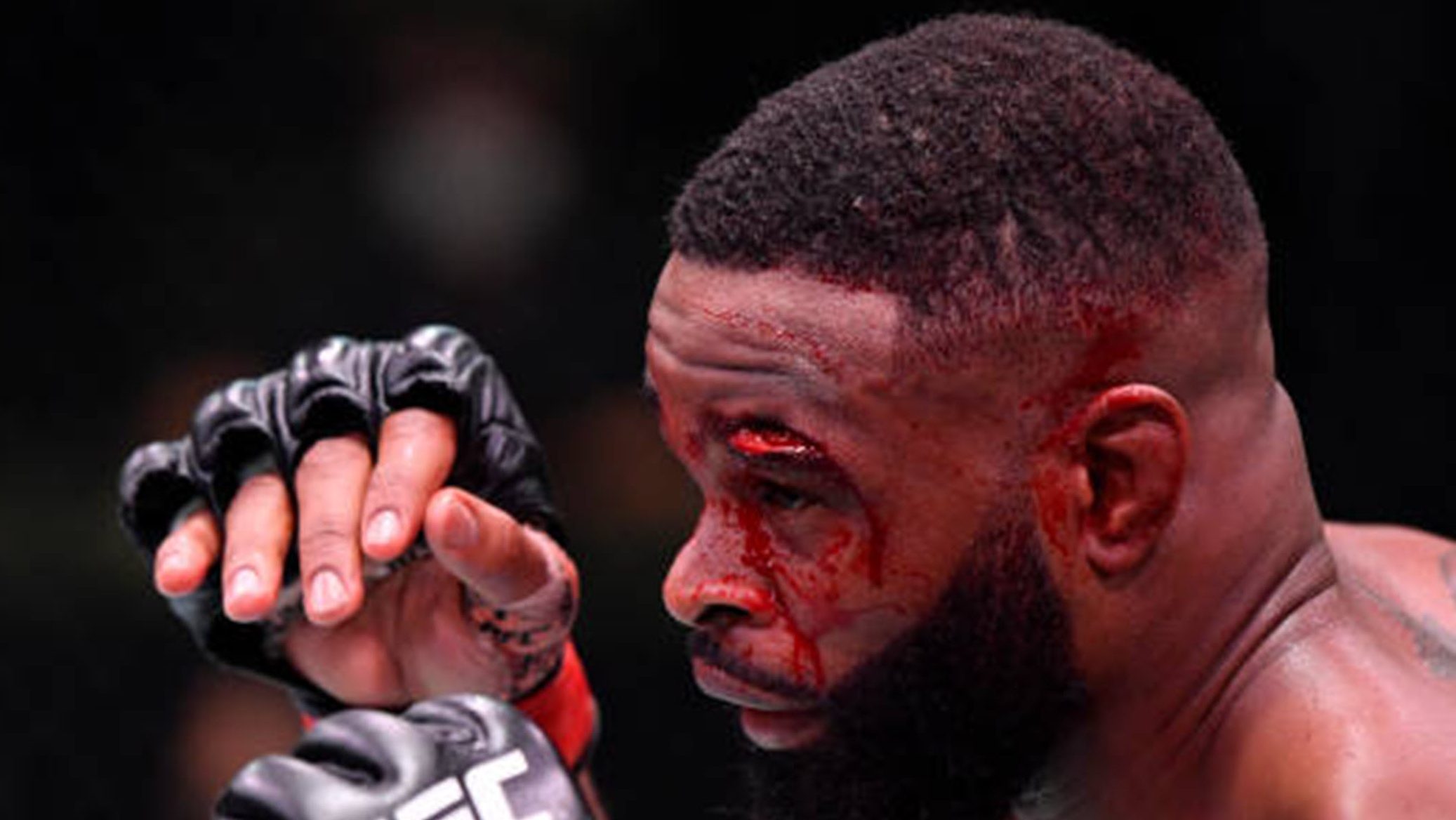 UFC on ESPN 9: Tyron Woodley's Cut and Other Images ...