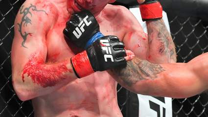 UFC Star Shares Graphic Injury Pics: ‘Chunk of My Lung’