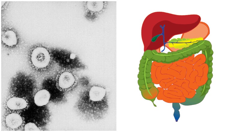 COVID19 GI Symptoms May Produce Worse Health