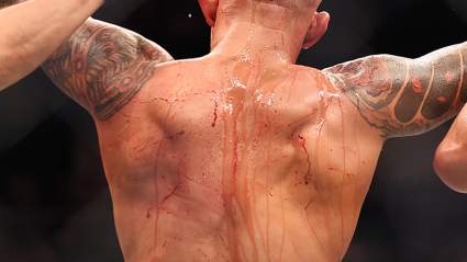Dana White: ‘He Didn’t Want To Fight’