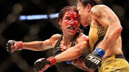 UFC Star Needs Plastic Surgeon After Losing ‘Big Chunk of Her Forehead’