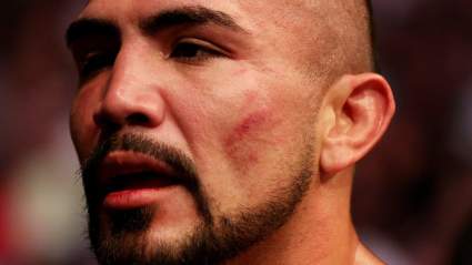 Fighter Shares Gruesome Aftermath of Horrific Injury in UFC Vegas 66 Win