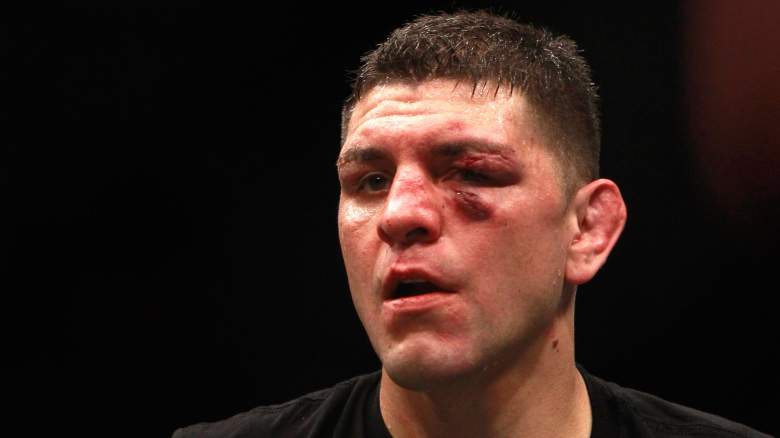 Nick Diaz