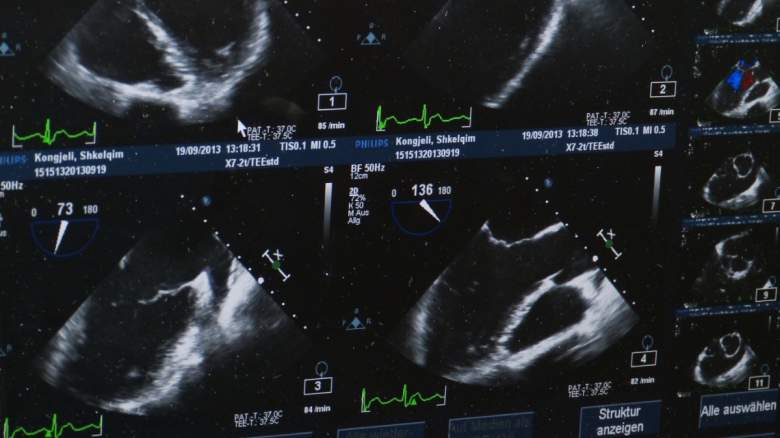 An ultrasound.