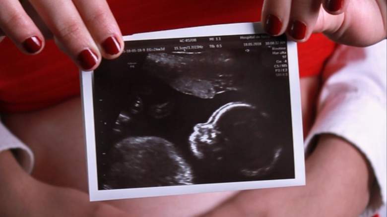 An ultrasound photo.