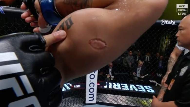 There was a bite fight in the UFC as Igor Severino clamps his teeth onto André Lima's biceps.