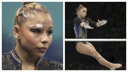Gymnast Flavia Saraiva Posts Video Showing Injured Eye After ‘Nasty’ Fall From Uneven Bars