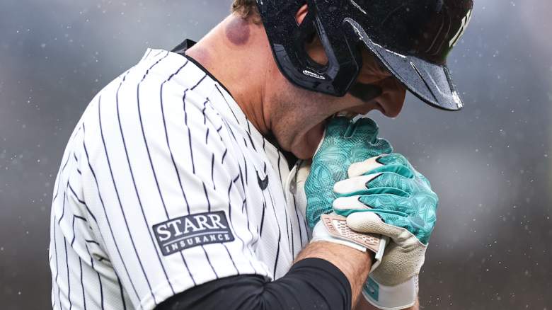 Anthony Rizzo bites his hand