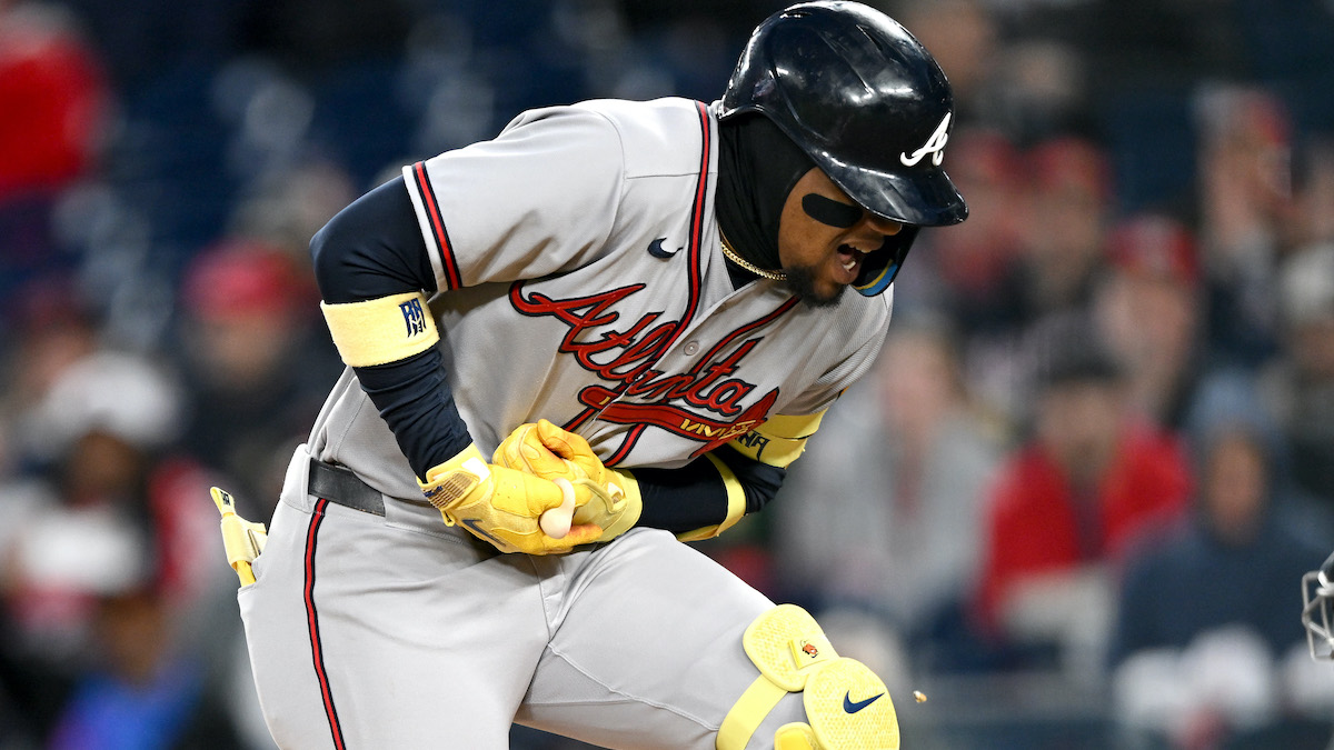 Atlanta Braves Announce Ronald Acuña Jr. X-Ray Results