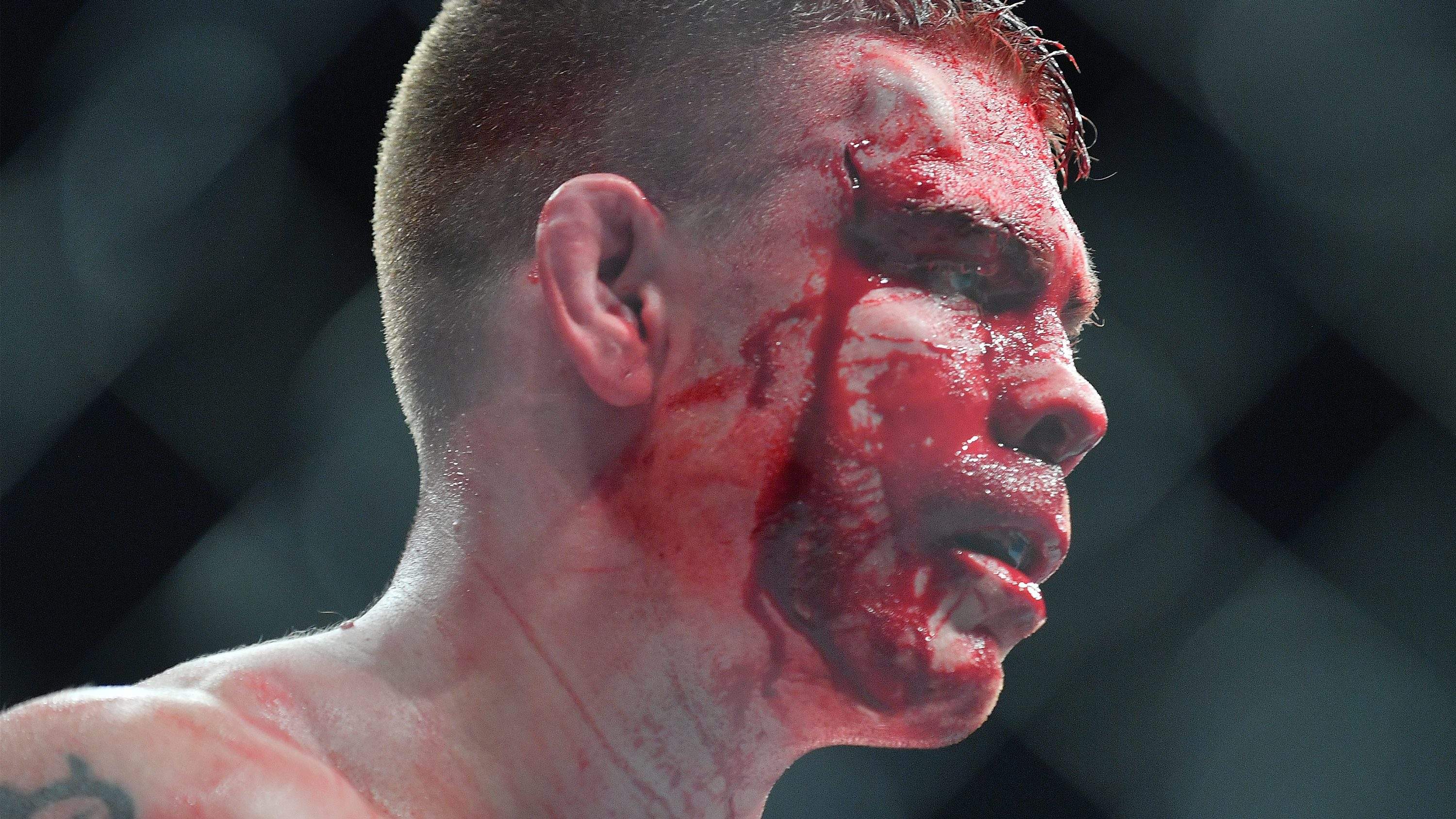 Image accompanying Heavy coverage of Paul Felder and Raoni Barcelos.