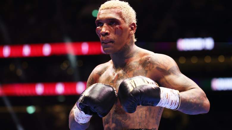 Conor Benn, seen with blood running down his cheek.